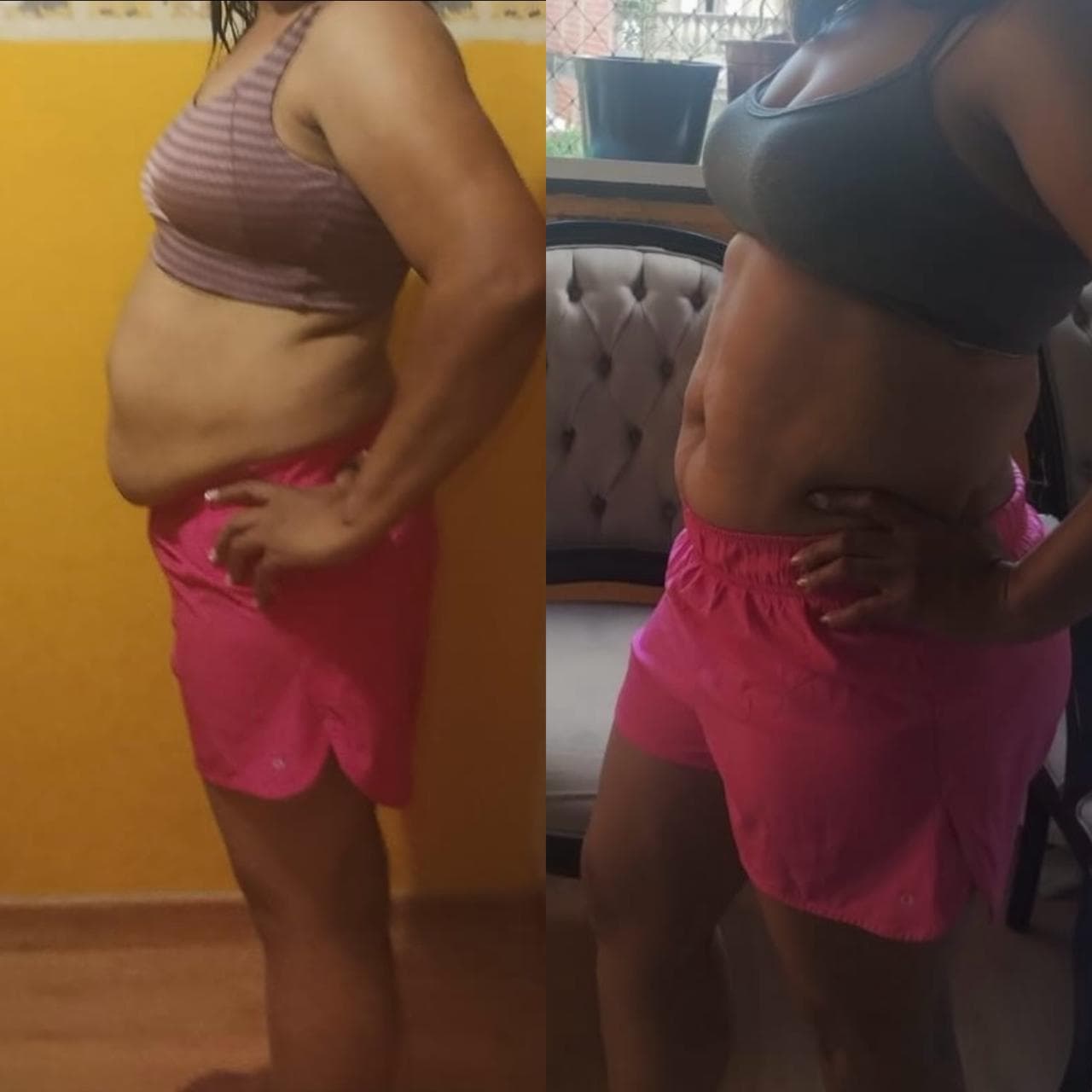 Comparativo de definição abdominal de aluna acompanhada